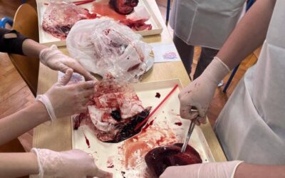 Srce na dlanu: sekcija puna uzbuđenja i “kuckanja”!