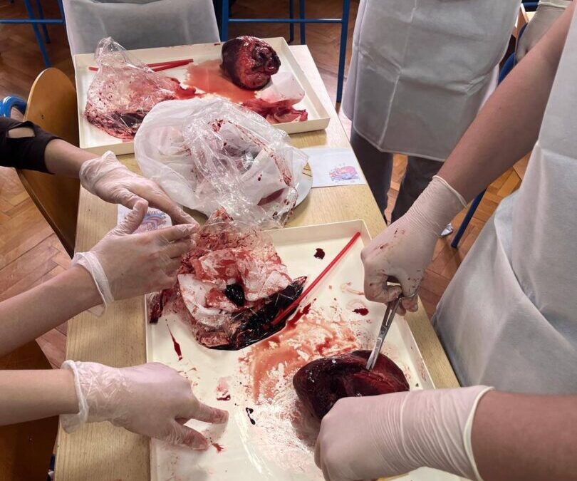 Srce na dlanu: sekcija puna uzbuđenja i “kuckanja”!